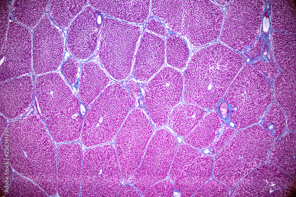 Tissue Of Liver Under The Microscope For Education In Laboratory