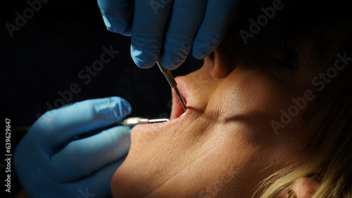 dental treatment. Woman getting her teeth cleaned and having implant treatment