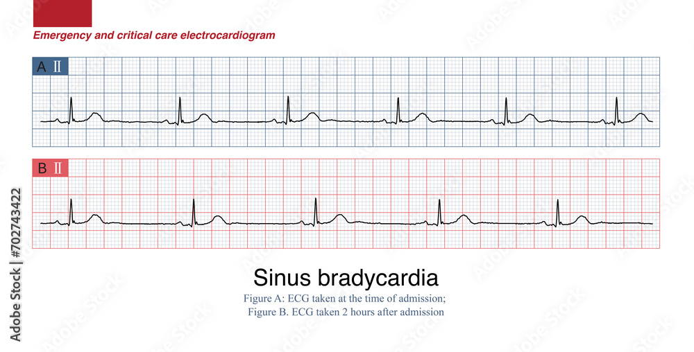 A Year Old Man Presents With Heart Palpitations Numbness Of The