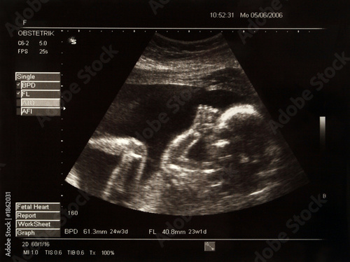 Fototapeta picture of a baby in the belly of her mother