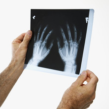 Man Holding A X-ray.