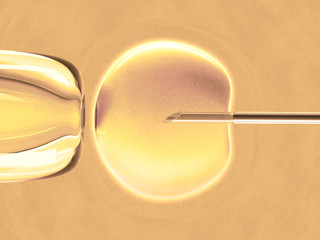 Poster - In vitro fecundation using sperm (warm color)