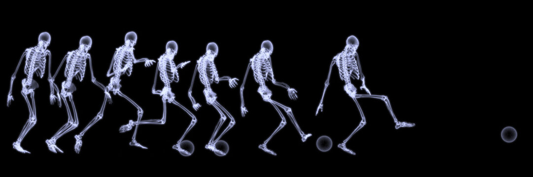 Xray of human skeleton playing soccer