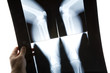 knee x-ray photo