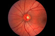 Retina - Optic Nerve - Human Eye