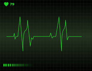 Heart monitor