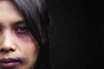 Domestic violence victim