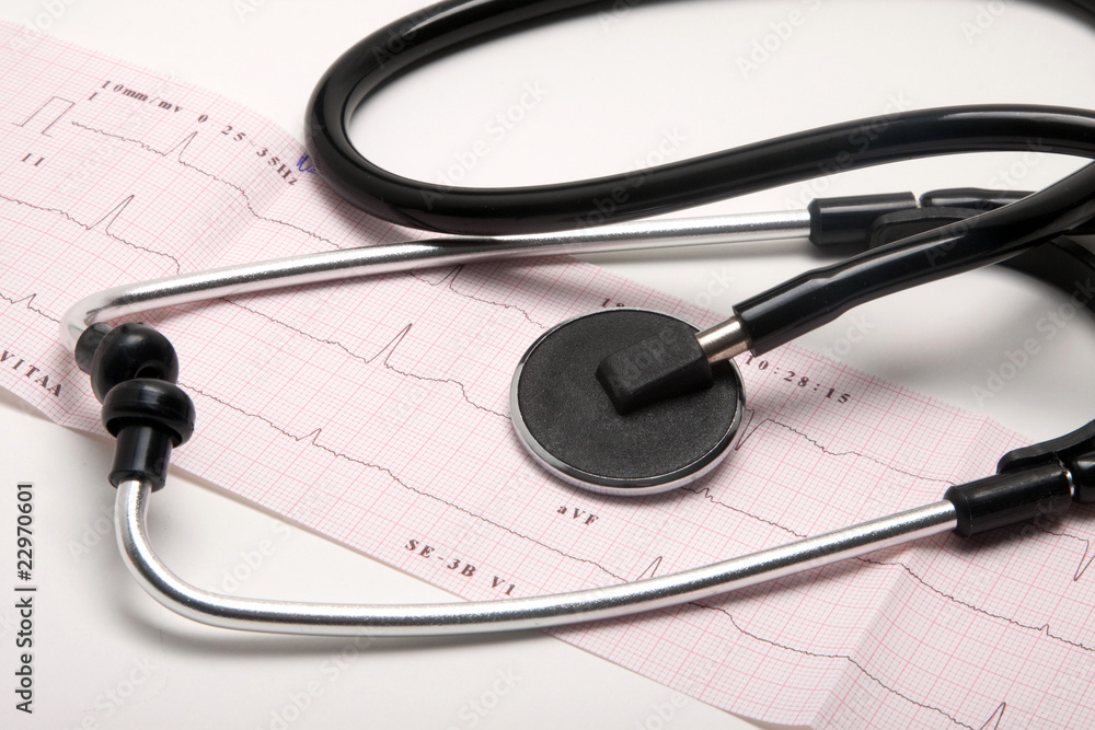 Wydruk EKG z przychodni zdrowia i stetoskop - obrazy, fototapety, plakaty 