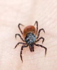 Poster - Tick crawling on human skin.