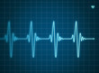 Électrocardiogramme bleu