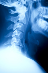 Naklejka na meble C-Spine - Xray