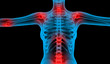 © hubis3d - painful joints x-ray low body