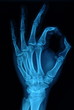 rentgen dłoń