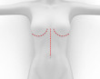 Chirurgia Plastica al seno