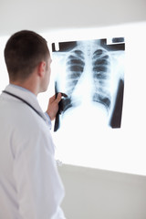 Wall Mural - Doctor holding x-ray against light