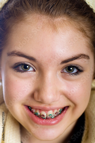 Teenaged Girl With Mouth Full Of Braces – Stock Foto Adobe Stock
