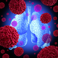 Wall Mural - lung cancer