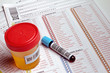 © angellodeco - medical report and test containers to an analytical study