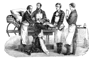 Wall Mural - amputation of the thigh. positions of the surgeon and assistants