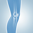 Kniegelenk - Röntgenbild - 3D Grafik