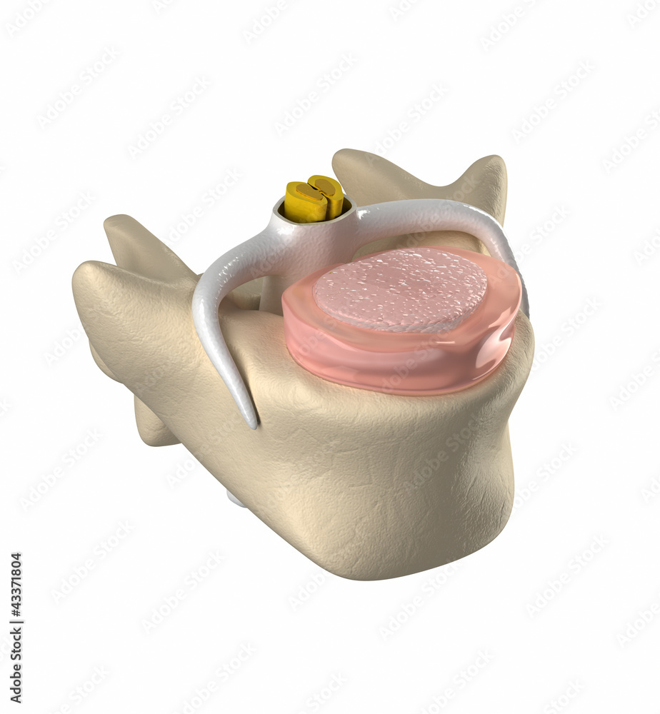 Pulpus Normal intervertebral disc, spinal cord and nucleus pulposus Stock ...