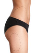© Karramba Production - Body correction with the help of plastic surgery, isolated