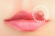 Close up of lips affected by herpes (cold sore)