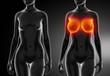 © CLIPAREA.com - Female breast comparison after plastic surgery