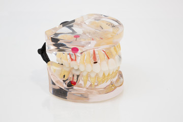 Wall Mural - Plastic model of human denture