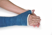 Broken Wrist, Arm With A Blue Fiberglass Cast On A White Backgro