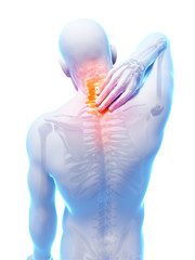 3d rendered illustration - painful neck