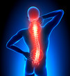 © decade3d - Male Hurt Backbone