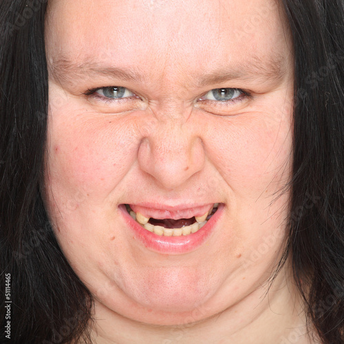 Obese woman with missing teeth. Stock 사진 Adobe Stock