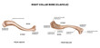 Clavicle (collar bone). Medical illustration.
