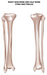 © reineg - shin bone and calf bone (tibia and fibula)