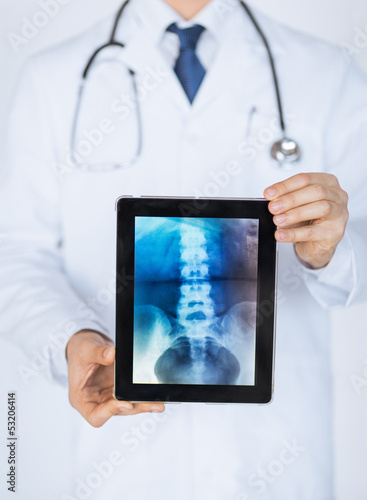 Fototapeta na wymiar male doctor holding tablet pc with x-ray