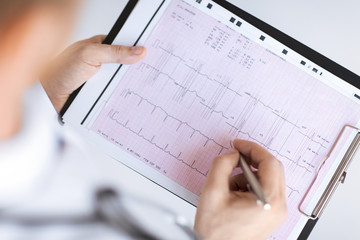 Canvas Print - male doctor hands with cardiogram