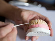 © xy - Dentist showing dental cast