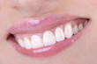© oksanka - Woman teeth