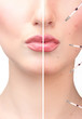 © Africa Studio - Woman's face before and after injection of acne and lip