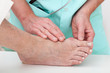 © Photographee.eu - Health problems - Hallux