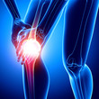 © pankajstock123 - X-ray human of knee pain