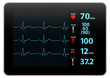 Modern Electrocardiogram Monitor Device Display