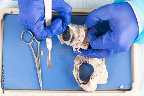 Fotografia, Obraz Physiology student dissecting a sheep eye