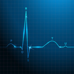 Poster - Normal heart rhythm blue background design