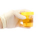 © tomschoumakers - Hand holding an urine sample