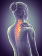 © Sebastian Kaulitzki - woman having a painful neck - visible spine