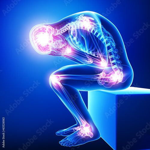 Fotografía Anatomy of male brain pain with all joints pain in blue