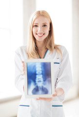 Poster - female doctor with x-ray on tablet pc