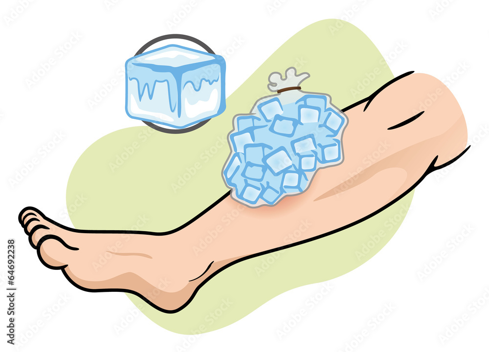 ice pack on leg